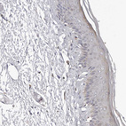 Immunohistochemical staining of human skin shows no positivity in squamous epithelial cells as expected.
