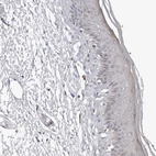 Immunohistochemical staining of human skin shows no positivity in squamous epithelial cells as expected.