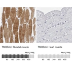 Anti-TMOD4 Antibody