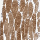 Immunohistochemical staining of human skeletal muscle shows high expression.