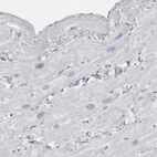 Immunohistochemical staining of human heart muscle shows low expression as expected.