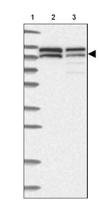 Lane 1: Marker [kDa] 230, 130, 95, 72, 56, 36, 28, 17, 11_br/_Lane 2: Human cell line RT-4_br/_Lane 3: Human cell line U-251MG sp