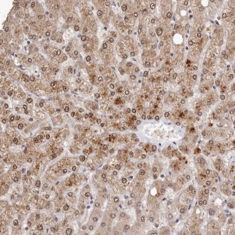 Anti-SULT1E1 Antibody