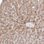 Anti-SULT1E1 Antibody