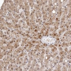 Anti-SULT1E1 Antibody