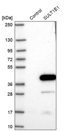 Western blot analysis in control (vector only transfected HEK293T lysate) and SULT1E1 over-expression lysate (Co-expressed with a C-terminal myc-DDK tag (~3.1 kDa) in mammalian HEK293T cells, LY417314).