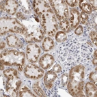 Immunohistochemical staining of human kidney shows moderate to strong cytoplasmic positivity in cells in tubules.