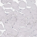 Immunohistochemical staining of human skeletal muscle shows no positivity in myocytes as expected.