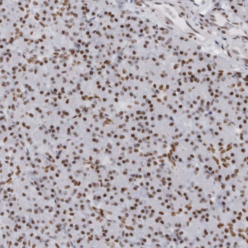 Anti-HP1BP3 Antibody