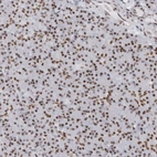 Anti-HP1BP3 Antibody
