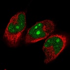 Anti-NVL Antibody