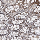Immunohistochemical staining of human colon shows moderate cytoplasmic positivity in glandular cells.