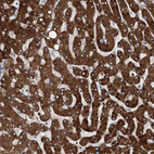 Immunohistochemical staining of human liver shows strong cytoplasmic positivity in hepatocytes.