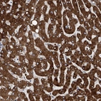 Immunohistochemical staining of human liver shows strong cytoplasmic positivity in hepatocytes.