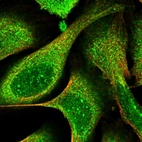 Immunofluorescent staining of human cell line U-2 OS shows localization to nuclear bodies & cytosol.