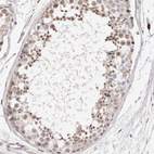 Anti-CASZ1 Antibody