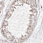 Anti-CASZ1 Antibody