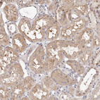Immunohistochemical staining of human kidney shows moderate cytoplasmic positivity in cells in tubules.