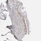 Immunohistochemical staining of human skin shows strong nuclear positivity in keratinocytes.