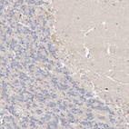Immunohistochemical staining of human cerebellum shows negative cytoplasmic positivity in Purkinje cells as expected.
