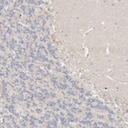 Immunohistochemical staining of human cerebellum shows negative cytoplasmic positivity in Purkinje cells as expected.