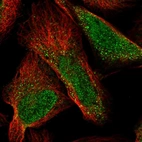 Immunofluorescent staining of human cell line U-2 OS shows localization to nucleoplasm & vesicles.