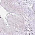Anti-NVL Antibody