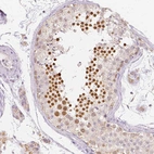 Immunohistochemical staining of human testis shows strong nuclear positivity in subset of cells in seminiferous ducts.
