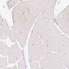 Immunohistochemical staining of human skeletal muscle shows no positivity in myocytes as expected.