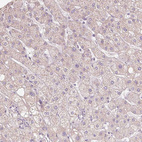 Anti-NVL Antibody