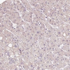 Immunohistochemical staining of human liver shows no positivity in hepatocytes as expected.