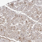 Immunohistochemical staining of human heart muscle shows moderate membranous positivity in cardiomyocytes.