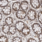 Immunohistochemical staining of human colon shows moderate nuclear positivity in glandular cells.