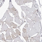 Immunohistochemical staining of human skeletal muscle shows very weak positivity in myocytes.