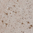 Anti-RASGEF1C Antibody