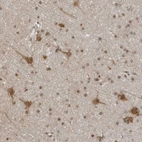 Anti-RASGEF1C Antibody