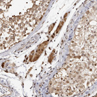 Immunohistochemical staining of human testis shows strong cytoplasmic and nuclear positivity in Leydig cells.