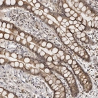 Immunohistochemical staining of human colon shows moderate cytoplasmic and nuclear positivity in glandular cells.