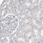 Anti-DDX54 Antibody