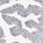 Immunohistochemical staining of human fallopian tube shows weak to moderate positivity in nucleoli of glandular cells.