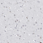Immunohistochemical staining of human cerebral cortex shows moderate to strong positivity in nucleoli of neurons.