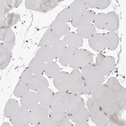 Immunohistochemical staining of human skeletal muscle shows weak to moderate positivity in nucleoli of myocytes.