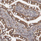 Anti-FGFR4 Antibody