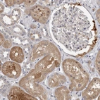 Immunohistochemical staining of human kidney shows moderate cytoplasmic positivity in cells in tubules.
