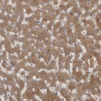Immunohistochemical staining of human liver shows moderate cytoplasmic positivity in hepatocytes.