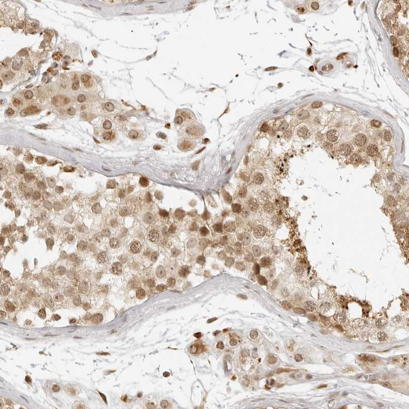 Anti-ZNF407 Antibody