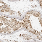 Anti-ZNF407 Antibody