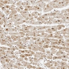 Immunohistochemical staining of human heart muscle shows strong nuclear positivity in cardiomyocytes.
