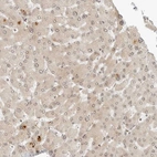 Immunohistochemical staining of human liver shows very weak positivity in hepatocytes.
