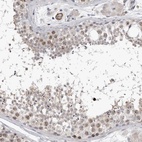 Immunohistochemical staining of human testis shows high expression.